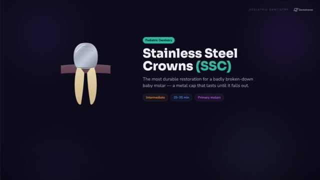 Stainless Steel Crowns — video lesson